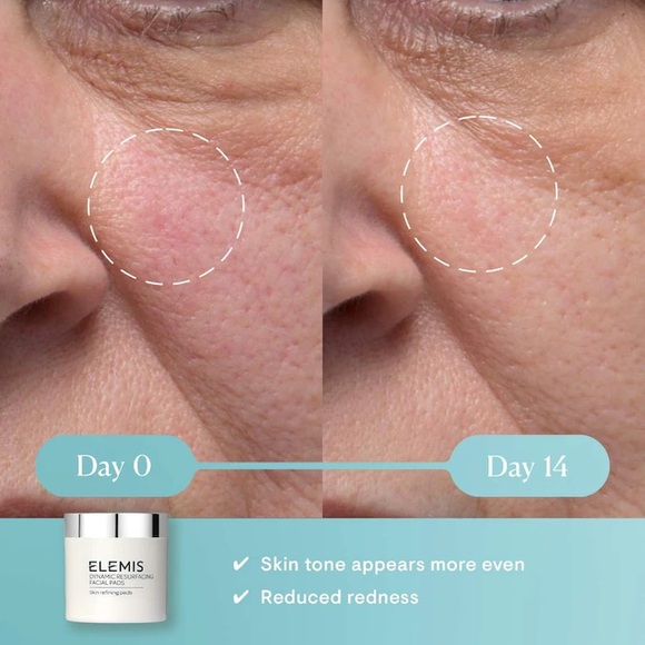 Elemis Dynamic Resurfacing Facial Pads Limited EDT Refining 60ct NEW Dark Spots - Picture 4 of 7